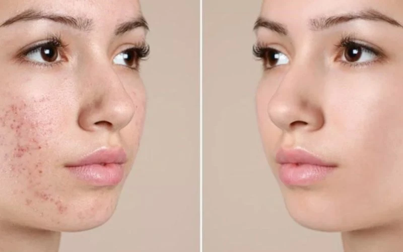 Tác Dụng Làm Đẹp Của Rượu Sake